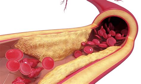 interconnectivity   arterial system combining peripheral
