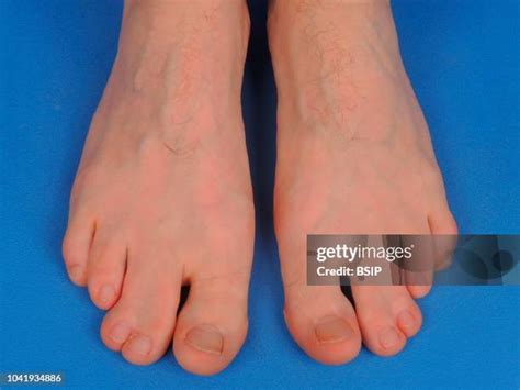2,388 Webbed Foot Stock Photos, High-Res Pictures, and Images - Getty ...