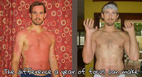 My Psoriasis Diet - ABCs & 123s Of Healing Naturally - A Warrior Curing ...