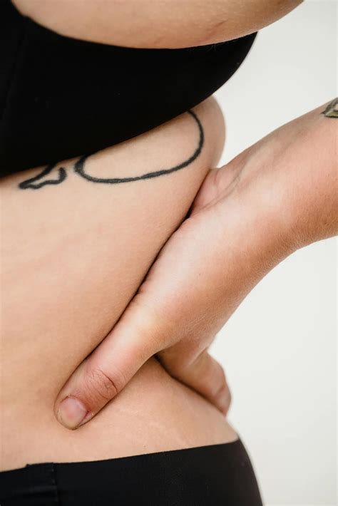 CMC Joint Repair Cleveland | Thumb Arthritis | Dr. Green