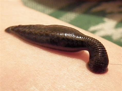 shocking benefits  leech    health gadgetsng