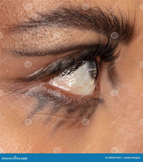 Close-up of a Girl& X27;s Black Eye. Macro Stock Photo - Image of ...