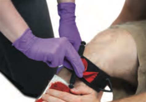 Severe Bleeding: How to Use a Tourniquet