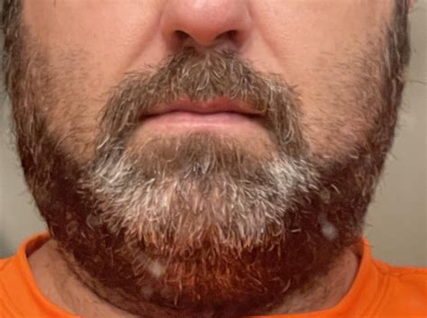 No Shave November: : r/TheRealFriendsOver40