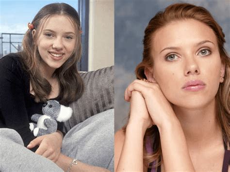 Rate Scarlett Johansson . Before and after rhinoplasty ...