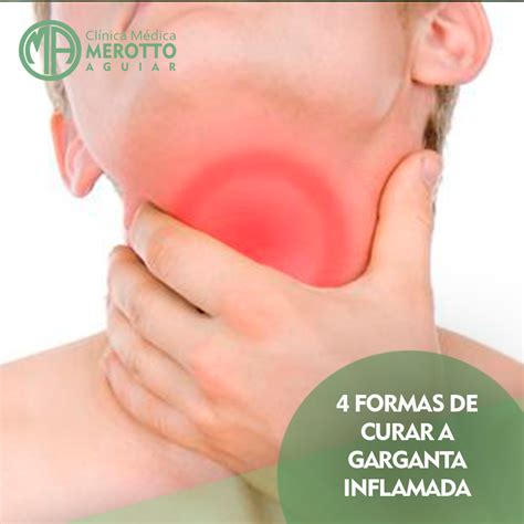 Garganta Seca E Ardendo - Clínica Médica Merotto Aguiar - A garganta inflamada pode gerar ...