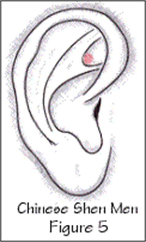 shen men  critical assessment  advanced auricular therapy