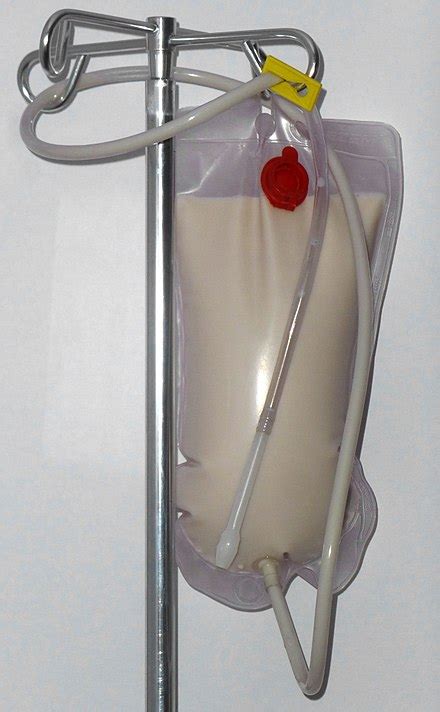 Ирригоскопия — Википедия