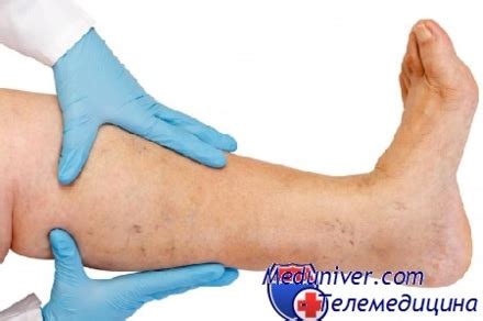 От чего немеют ноги? Как лечить онемение ног?
