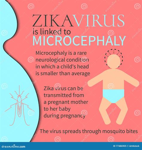 Microcephaly Vector Linear Icon Isolated On Transparent Background