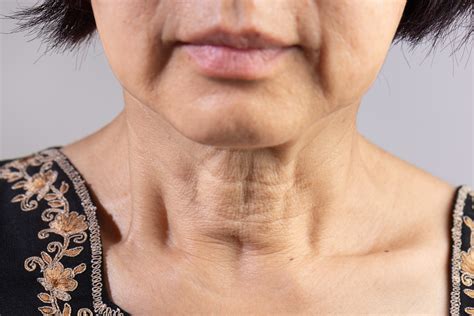how to fix sagging skin on neck