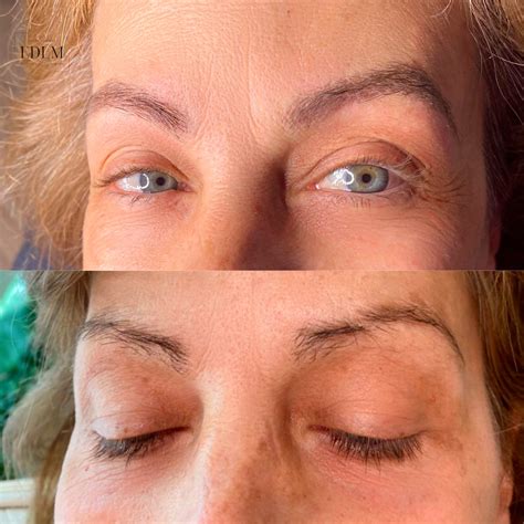 Microblading Antes Y Despues 4