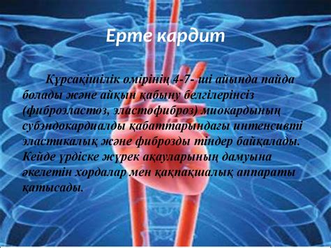 Туа пайда болған кардит. Клиникасы. Диагнозы - презентация онлайн