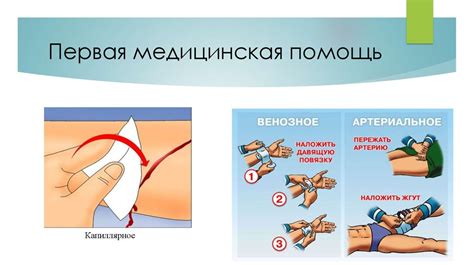 Первая медицинская помощь при кровотечениях и травмах. Использование ...