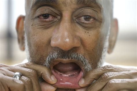 Texas prisons often deny dentures to inmates with no teeth | AP News