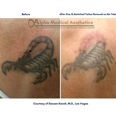 Alpha Medical Aesthetics - Medical Spa - Las Vegas, NV