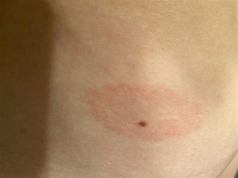 Habt ihr eine idee was es sein könnte? (Haut, Hautprobleme)