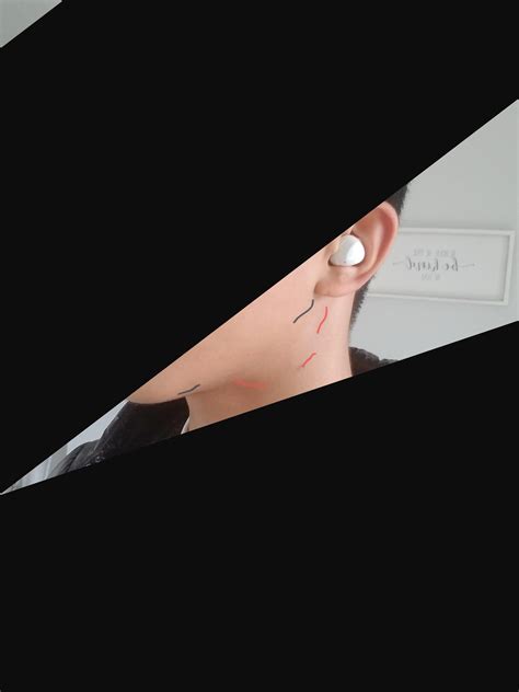How long do swollen lymoh nodes last for? : r/Mewing