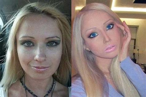 Barbie Extreme Plastic Surgery