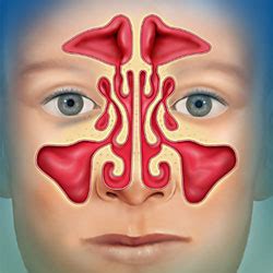 Advanced Procedures - Raleigh Capitol Sinus & Allergy Center