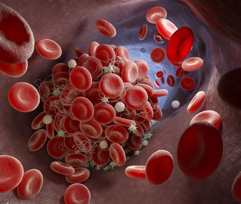 Sangue Coagulado E Perigoso - Sangue Coagulado E Perigoso - NAZAEDU