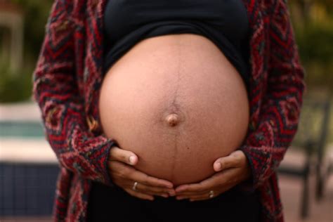 Linha Nigra Aparece Com Quantas Semanas - A Linha Nigra Pode Aparecer Nas Primeiras Semanas - BRAINCP