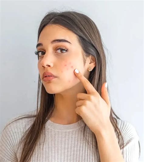 skin issues