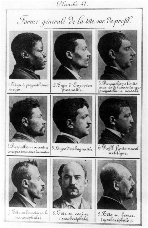 35 Disturbing Photos From The Heyday Of Eugenics