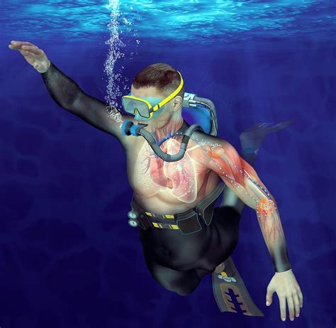 Decompression Sickness Photograph by Claus Lunau - Fine Art America