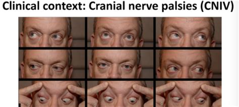 oc motility final flashcards quizlet