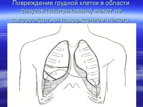 Ранения грудной клетки - презентация онлайн