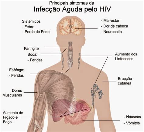 AIDS e HIV