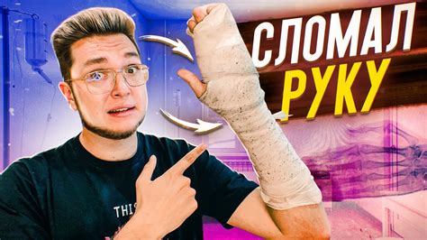 Я СЛОМАЛ РУКУ - YouTube