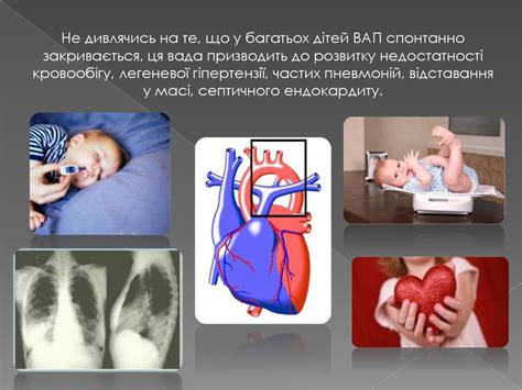 Відкрита артеріальна протока. Ізольований стеноз легеневої артерії ...