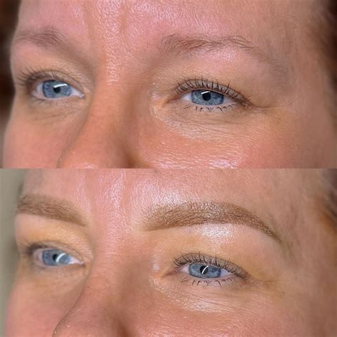 Honeydrip Aesthetics | Bonham TX