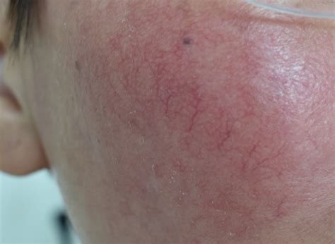 Dermatology Treatments for Skin Medical Conditions