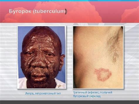 Кожа состоит из трех слоев: эпиде р