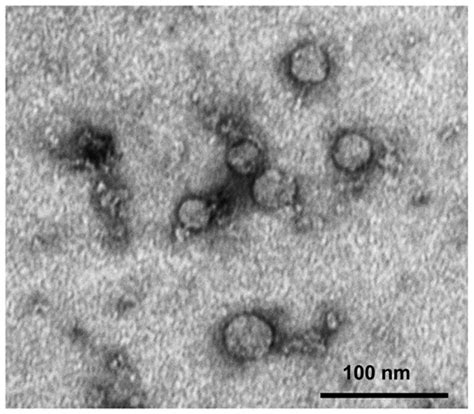 Transmission electron microscopy (TEM) of exosomes isolated from ... 