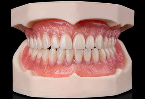 full acrylic denture mtz dental lab