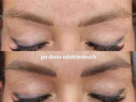 Odstranění permanentního makeupu nebo tetování Hradec Králové, Hořice ...