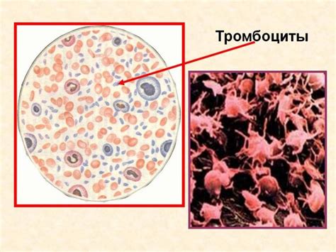 Средний объем тромбоцитов повышен - что это значит? Симптомы и лечение ...