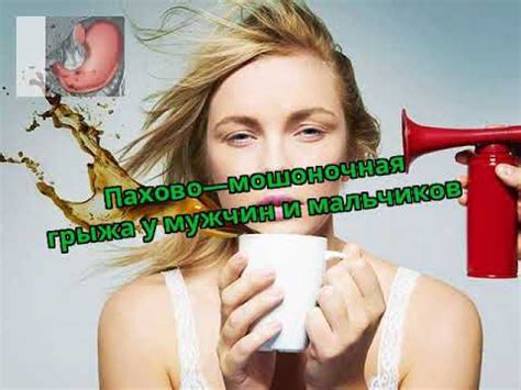 Пахово—мошоночная грыжа у мужчин и мальчиков - YouTube