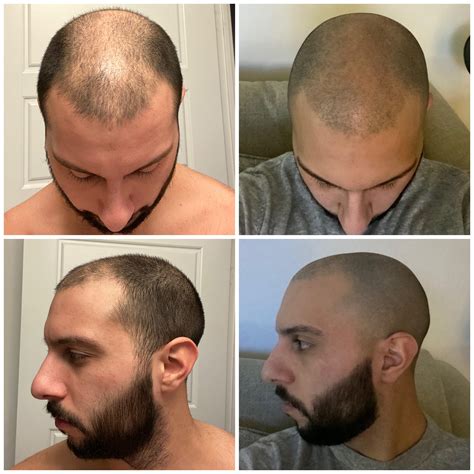 Detailed guides show why buzz fade haircut works for anyone 21