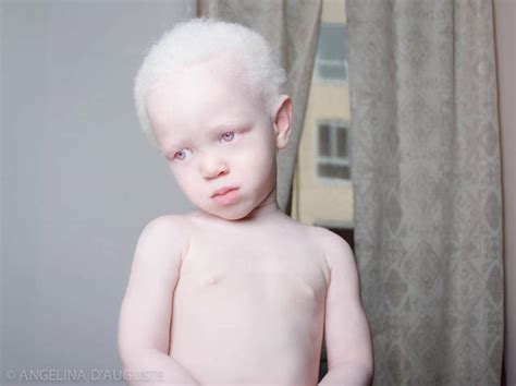 These Beautiful Albino People Are Simply Breathtaking (58 pics ...