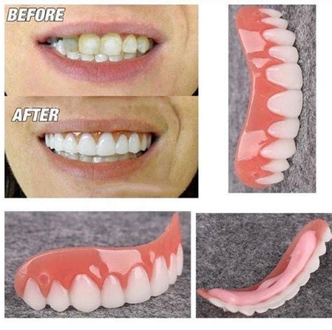 Купить Виниры Perfect Smile Veneers, в хитах, цена 102.68 ₴ — Prom.ua ...