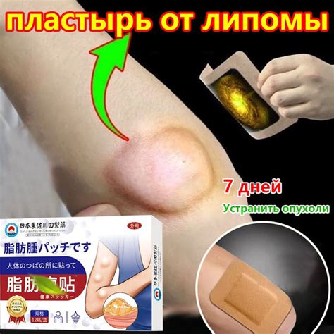 пластырь для удаления липомы 12 патчей для устранения кист сальной ...