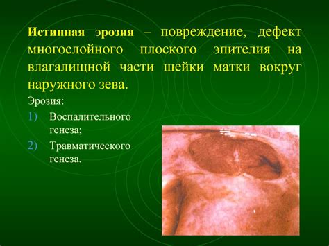 Опухоли женских половых органов - презентация онлайн