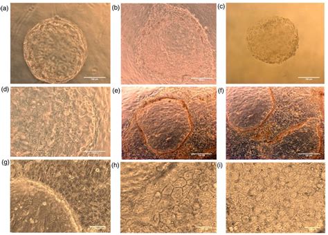 Trophectoderm cell culture: (a) Hatched blastocyst seeded onto the ... 