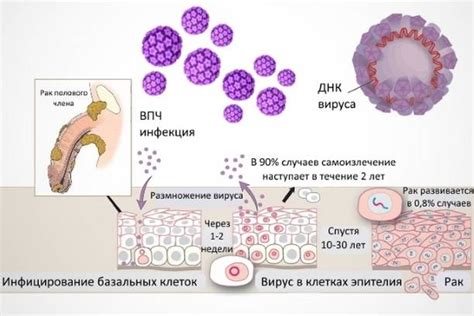 Впч 31 типа у женщин, что это такое: какие могут быть последствия, днк ...