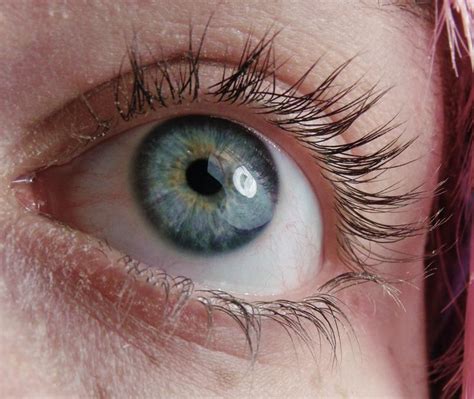 golden dappling around cerulean iris / central heterochromia eyes | Eye ...
